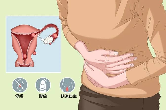 试管婴儿胚胎移植后有少量出血是怎么回事？试管婴儿过程中出血的原因有哪些？