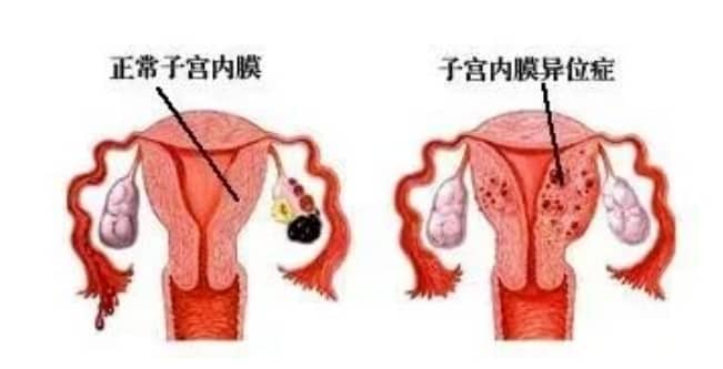 试管婴儿技术与体力活动在助孕中的效果有何差异？如何通过体力活动提高试管婴儿的成功率？