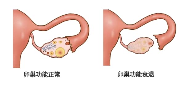 为什么越来越多的人怀不上？试管婴儿技术能否帮助因年龄大而难以怀孕的女性？