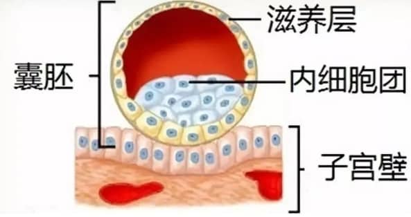 试管婴儿技术中反复移植失败的主要原因是什么？如何解决试管婴儿过程中的免疫因素导致的反复着床失败？