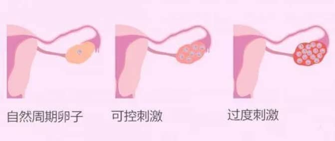 试管婴儿技术中促排卵药物的作用是什么？试管婴儿促排方案的选择如何影响胚胎培养结果？