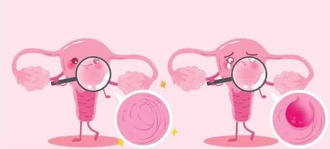 子宫内膜厚度怎么查？什么样的子宫内膜有利于怀孕？试管婴儿中什么样的子宫内膜条件最有利于胚胎着床？