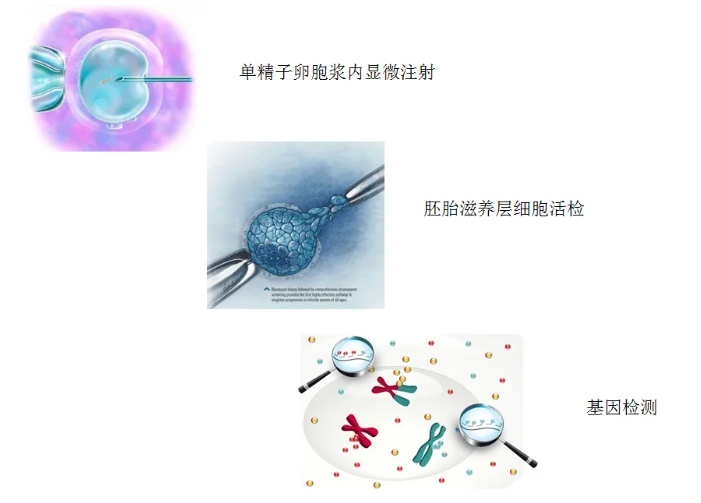 什么是未破裂卵泡黄素化综合征LUFS？LUFS的发病原因有哪些？LUFS患者在生育方面有哪些解决方案？