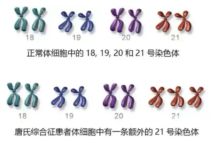 男性哪些问题会导致胎停育？胎停育真的是女性的错吗？男性因素不可忽视！