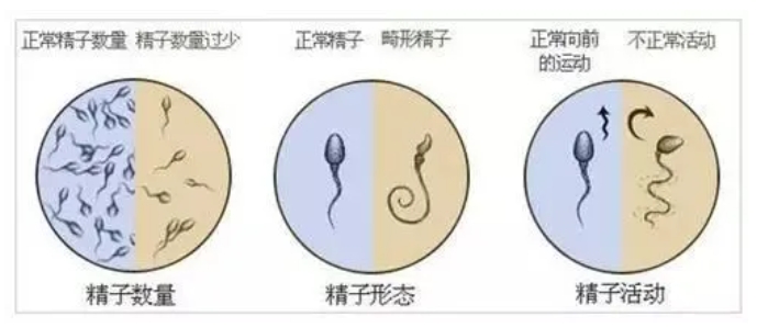 男性哪些问题会导致胎停育？胎停育真的是女性的错吗？男性因素不可忽视！