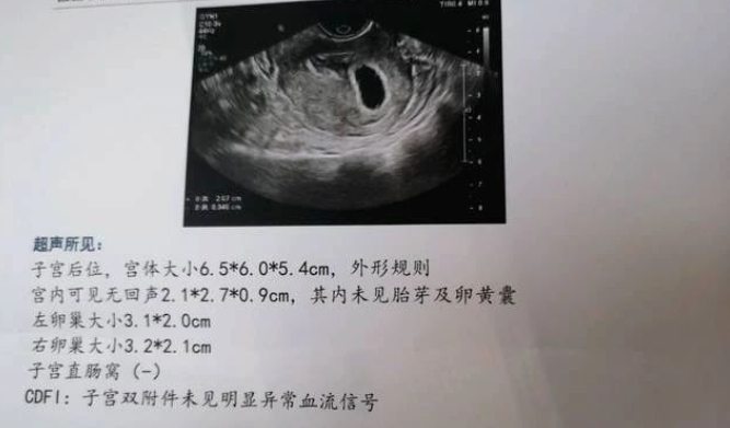 男性哪些问题会导致胎停育？胎停育真的是女性的错吗？男性因素不可忽视！