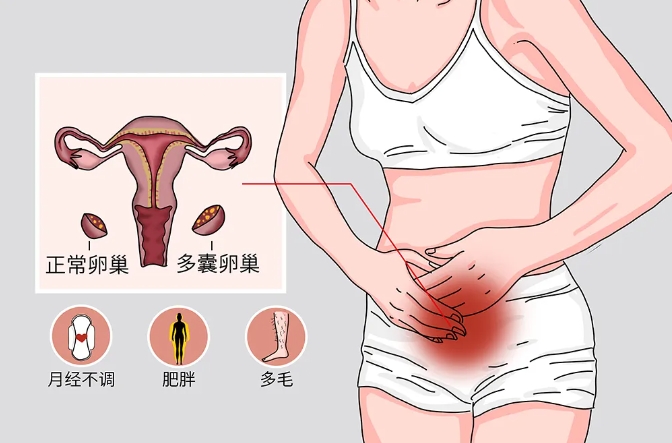 什么是胰岛素抵抗？胰岛素抵抗对试管婴儿有什么影响？如何应对胰岛素抵抗？
