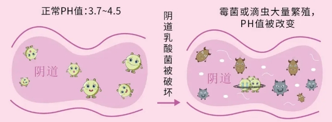 哪些因素会出现绒毛膜下出血？ 早孕期绒毛膜下出血该怎么办？绒毛膜下出血对怀孕有哪些影响？
