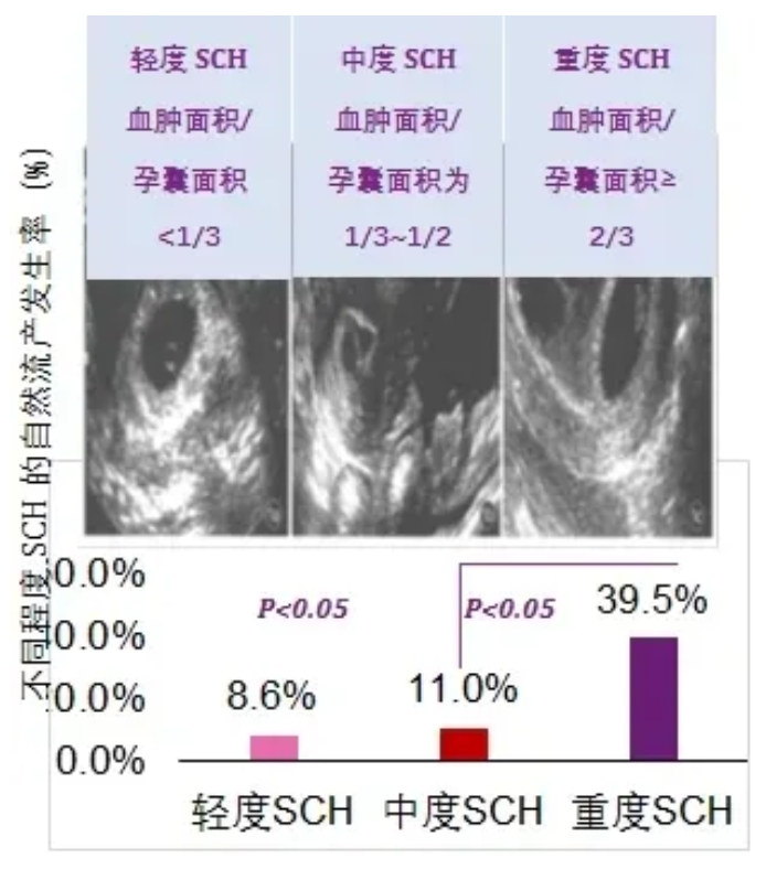 哪些因素会出现绒毛膜下出血？ 早孕期绒毛膜下出血该怎么办？绒毛膜下出血对怀孕有哪些影响？