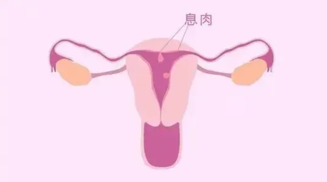 慢性子宫内膜炎的病因是什么？慢性子宫内膜炎对生殖有哪些影响？慢性子宫内膜炎的治疗措施有哪些？