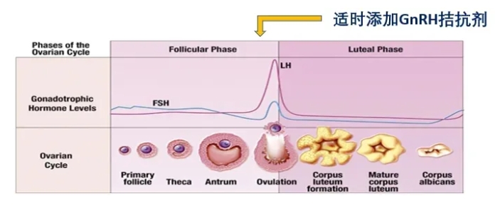高龄女性做试管婴儿如何选择合适的促排方案？高龄女性试管成功的关键是什么？