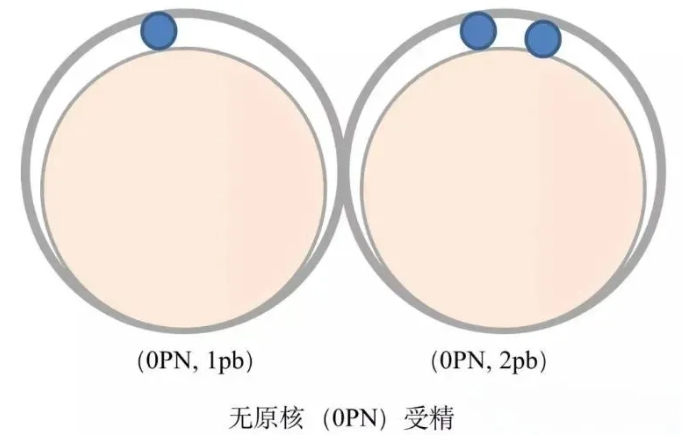异常受精的胚胎是否真的无法移植？体外受精过程中为什么会出现异常受精的情况？