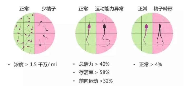 做试管婴儿，你的精液达标了吗？ 关于男性精子问题看这篇文章就够了！