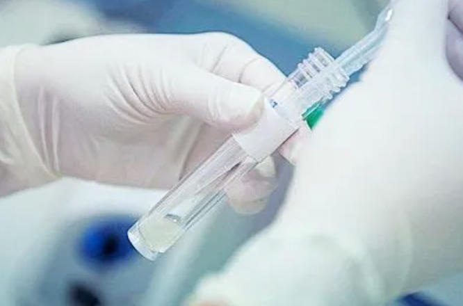 做试管婴儿，你的精液达标了吗？ 关于男性精子问题看这篇文章就够了！