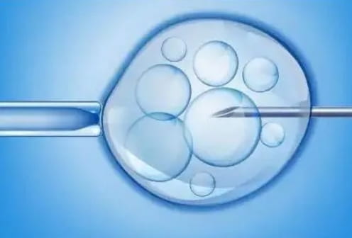 人工授精和试管婴儿是一回事吗？人工授精和试管婴儿的区别在哪里？