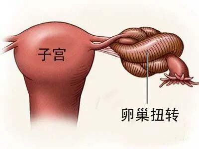 试管婴儿移植后为什么要补黄体酮?试管婴儿黄体酮怎么用?黄体酮对胚胎着床有多重要? 试管婴儿移植后为什么要补黄体酮?试管婴儿黄体酮怎么用?黄体酮对胚胎着床有多重要?