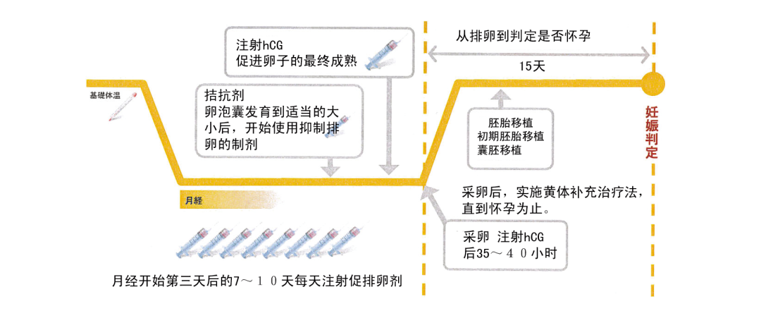 试管婴儿促排方案怎么选？最全试管促排方案合集，哪种适合你？