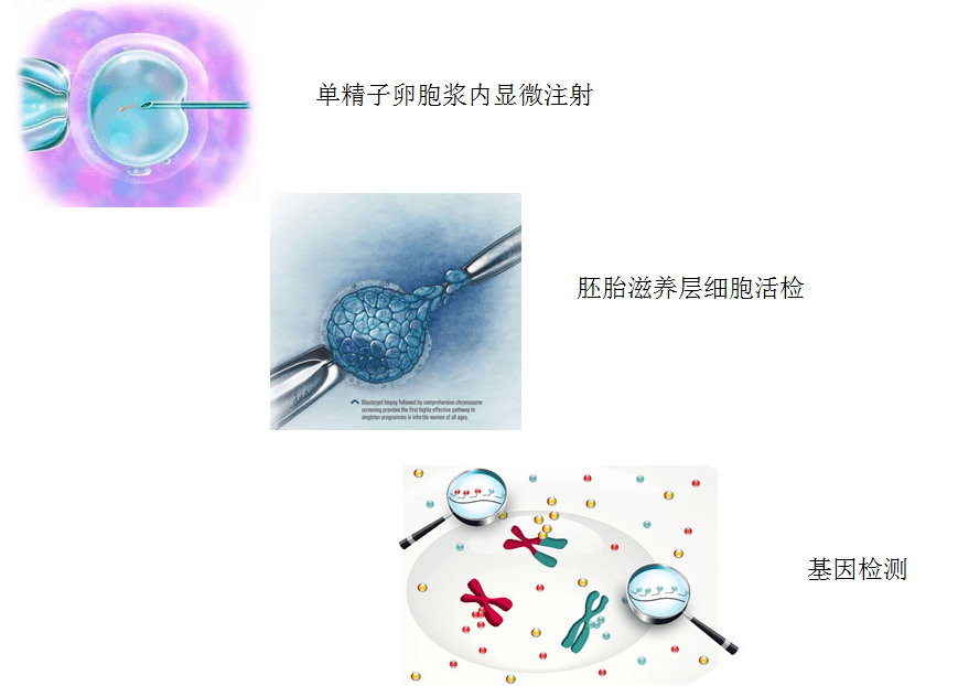 高龄备孕必看：嵌合体胚胎还能成功妊娠吗？如何应对嵌合体胚胎的风险？