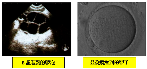 为什么卵泡数、取卵数、胚胎数，会层层"缩水"？试管婴儿胚胎数为何远少于卵泡数？