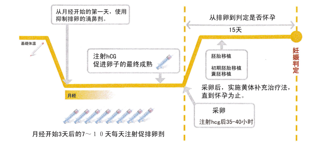 试管婴儿促排方案怎么选？最全试管促排方案合集，哪种适合你？