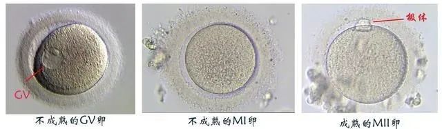 卵子成熟障碍还有机会怀孕吗？卵子成熟障碍患者如何实现生育梦想？