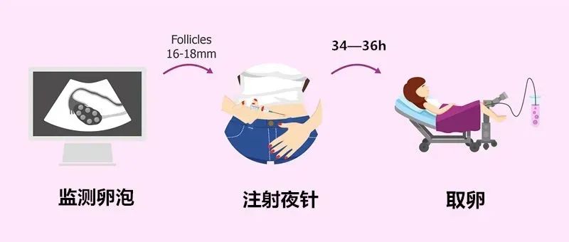 试管婴儿中的'夜针'是什么？为什么它如此重要？夜针注射时机如何影响试管婴儿成功率？