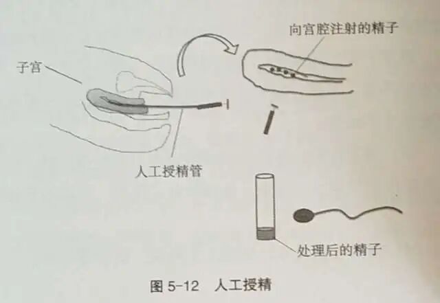 月经正常却怀不上?备孕期间如何科学排查不孕原因?月经正常适合做试管婴儿吗? 月经正常却怀不上?备孕期间如何科学排查不孕原因?月经正常适合做试管婴儿吗?