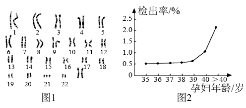 胎儿畸形高发期在什么时候？孕期如何避免胎儿畸形？高龄备孕如何预防胎儿畸形？
