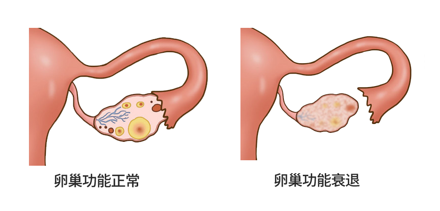 月经正常却怀不上?备孕期间如何科学排查不孕原因?月经正常适合做试管婴儿吗? 月经正常却怀不上?备孕期间如何科学排查不孕原因?月经正常适合做试管婴儿吗?