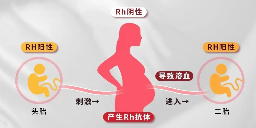 血型不合真的会导致新生儿溶血吗？​夫妻血型组合如何影响胎儿健康？​