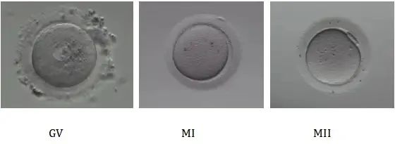 卵子成熟障碍还有机会怀孕吗？卵子成熟障碍患者如何实现生育梦想？