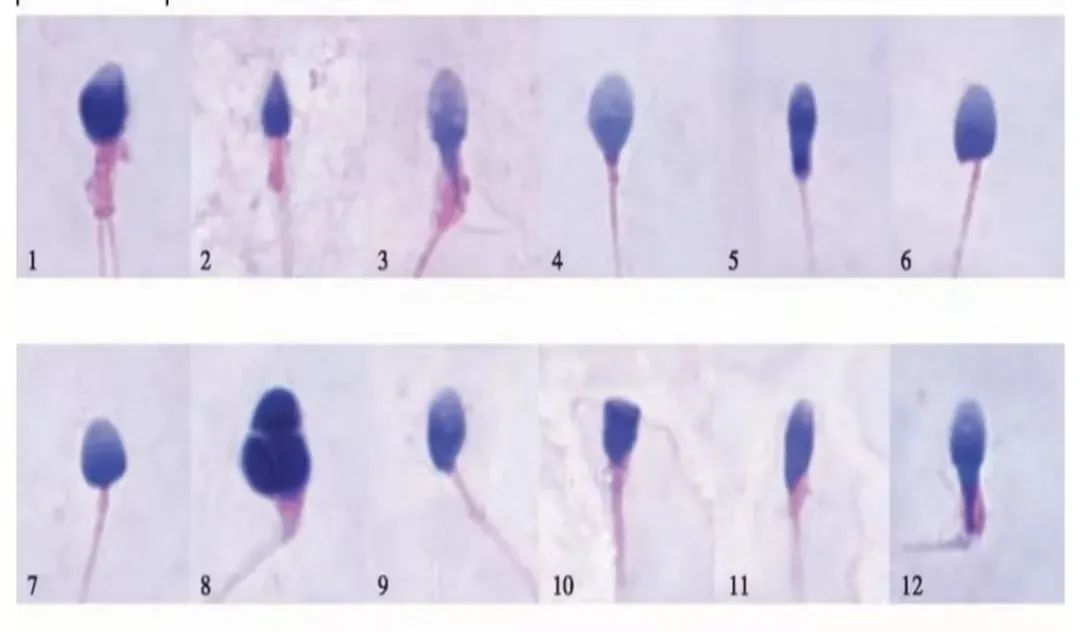 什么样的精子才算健康？精子形态异常会影响怀孕吗？备孕男性必看！