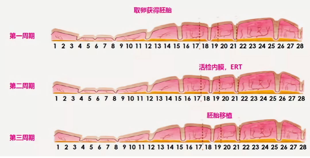 试管婴儿反复失败？可能是你错过了最佳移植'窗口期'！