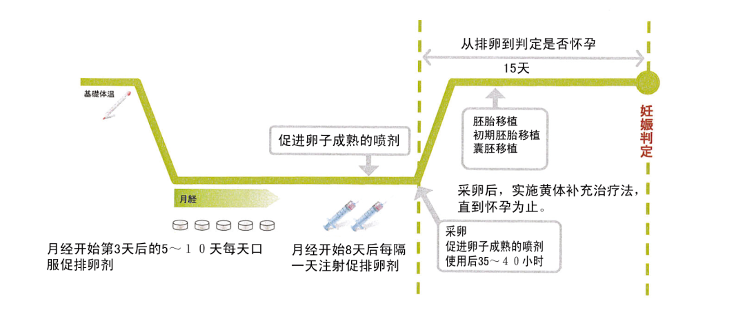 试管婴儿促排方案怎么选？最全试管促排方案合集，哪种适合你？