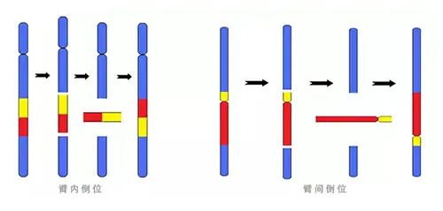 ​哪些因素最容易导致胚胎停育？ ​如何通过症状判断是否发生了胎停？