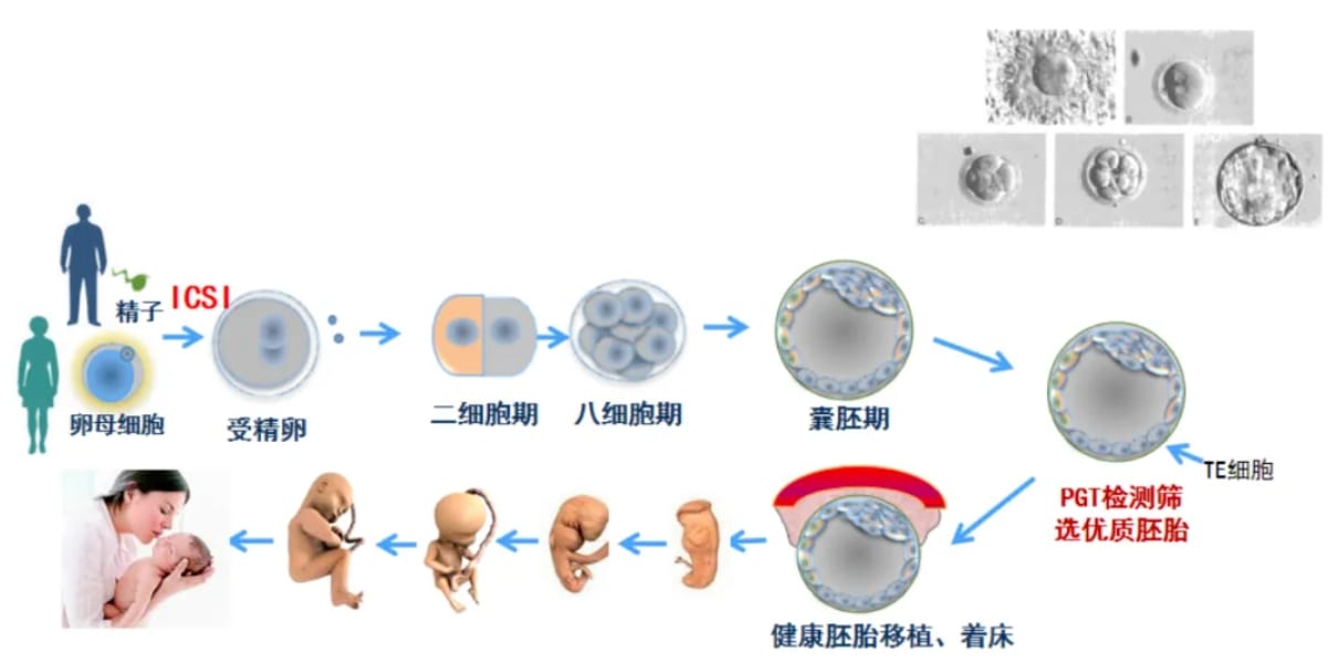 试管婴儿为什么总是移植失败？试管婴儿成功率的主要影响因素有哪些？