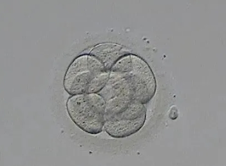 试管婴儿囊胚和D3胚的区别？试管婴儿囊胚移植成功率更高还是D3胚移植成功率更高？