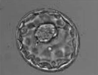 试管婴儿囊胚和D3胚的区别？试管婴儿囊胚移植成功率更高还是D3胚移植成功率更高？
