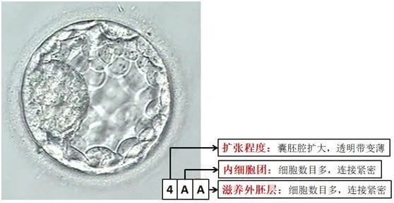试管胚胎等级解读，看完这篇你全懂！