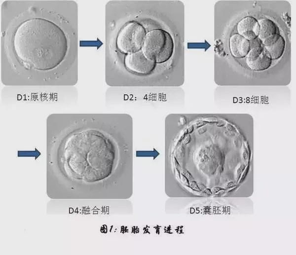 试管婴儿养囊失败的原因是什么？试管婴儿过程中如何有效改善胚胎质量？