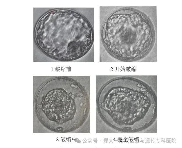 带你揭秘试管婴儿囊胚的冷冻与复苏！冷冻胚如何存放？冷冻时间长短会不会影响妊娠结局?