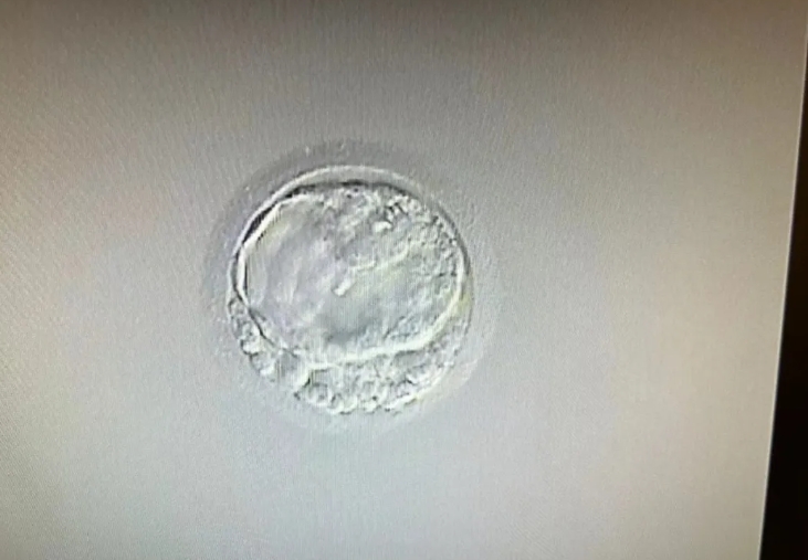 试管婴儿移植的胚胎数越多成功率越高吗？高龄试管人群更提倡单囊胚移植