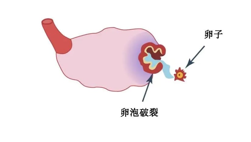 什么是试管婴儿优势卵泡？试管婴儿优势卵泡有什么特征？优势卵泡主导怀孕的绝对C位！