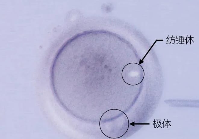 什么是纺锤体？纺锤体观测下的试管婴儿技术可让优胚率提升23%！