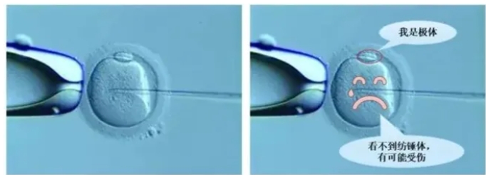 什么是纺锤体？纺锤体观测下的试管婴儿技术可让优胚率提升23%！