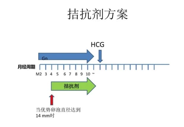 试管促排方案哪种更适合你？如何根据个人情况选择最合适的试管婴儿促排卵方案？