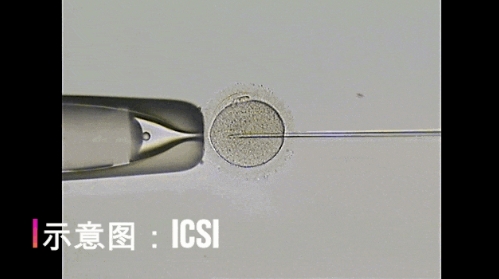 试管婴儿来“助攻”，让中秋更圆满！试管婴儿技术如何帮助不孕不育家庭实现生育梦想？