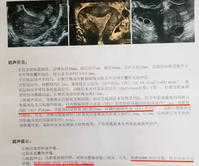 什么是子宫畸形？子宫畸形怎么诊断？子宫畸形对试管婴儿成功率有何影响？