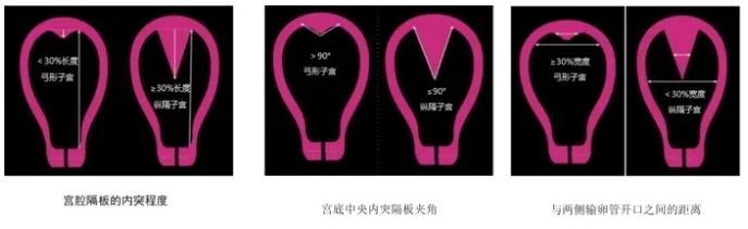 什么是子宫畸形？子宫畸形怎么诊断？子宫畸形对试管婴儿成功率有何影响？