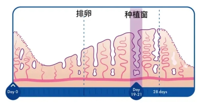 试管婴儿冻胚移植的内膜准备方案有哪几种？你适合哪一种冻胚移植的内膜准备方案？
